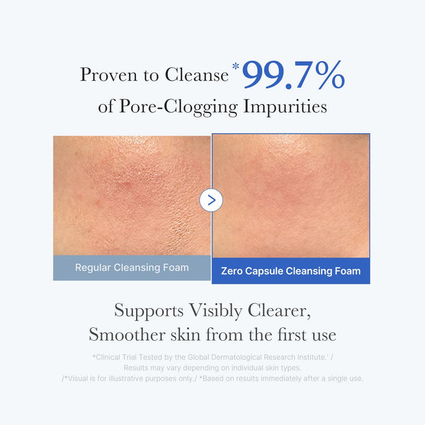 Gentle Multi-Acid Exfoliation