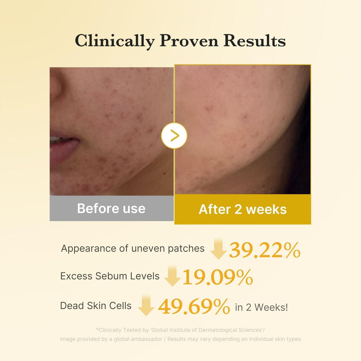 Kojic Turmeric Brightening Set