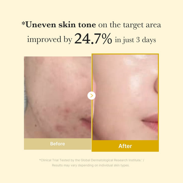 Daily Pads, Overnight Mask