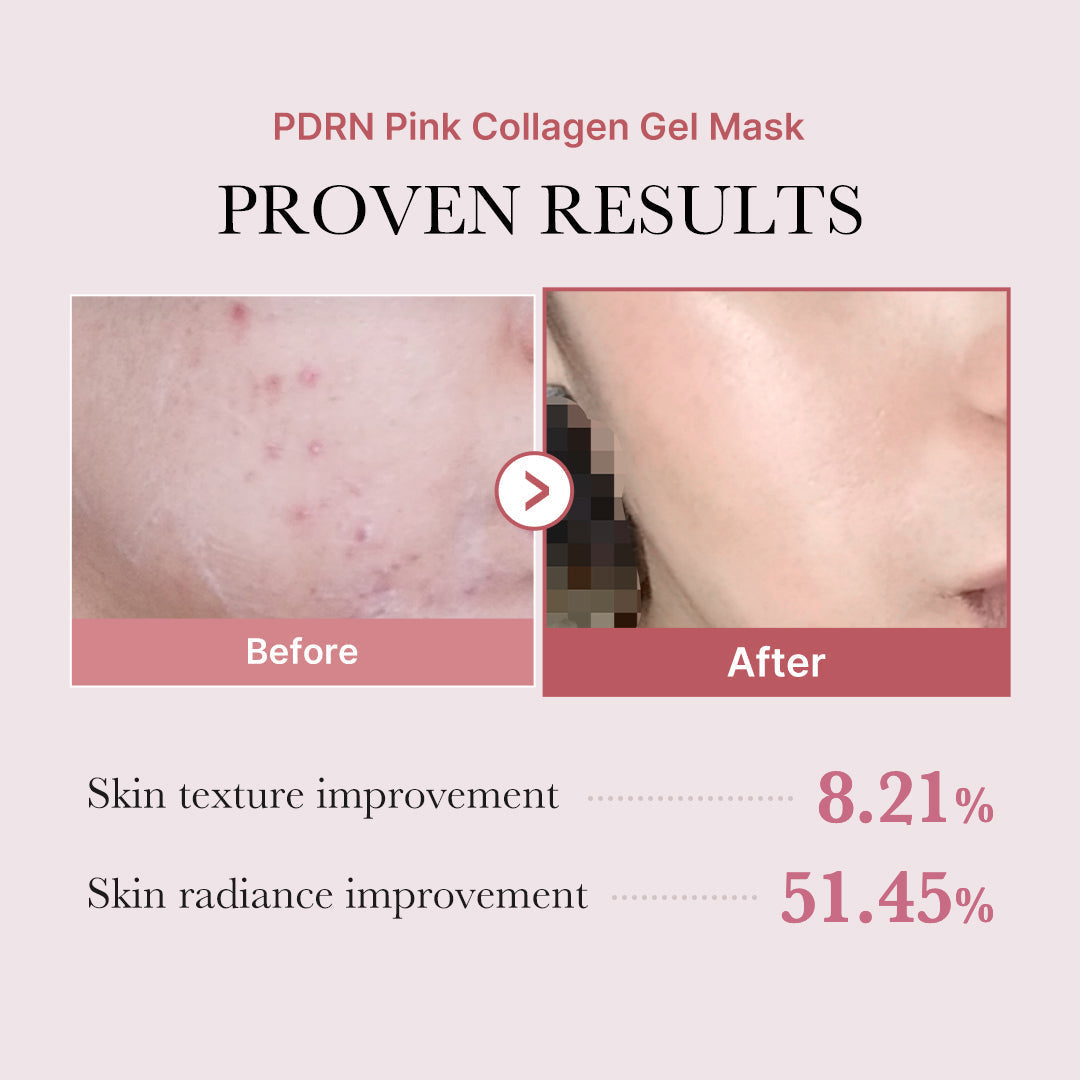 Gel mask results - skin texture and radiance improvement